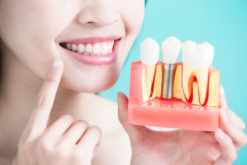Woman,Take,Tooth,Implant,False,Tooth,On,Green,Background