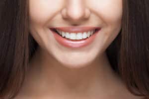 Beautiful,Woman,Smile.,Teeth,Whitening.,Dental,Care.