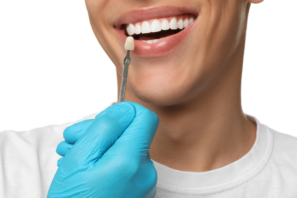 philly dental veneers
